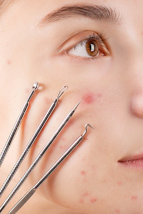 Bouton rouge sur le visage : causes et astuces pour agir vite